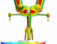 CFD Analyse